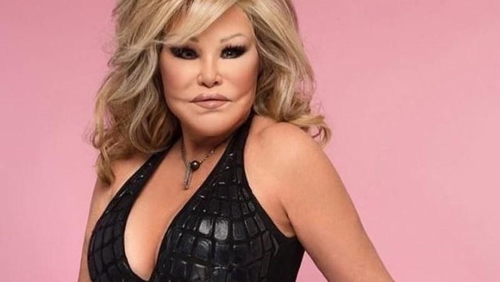 Duh! Kecanduan Oplas, 6 Selebriti Dunia Ini Malah Terlihat Aneh Duh! Kecanduan Oplas, 6 Selebriti Dunia Ini Malah Terlihat Aneh
