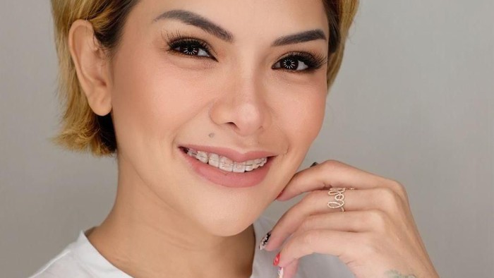 Tampilan Nikita Mirzani yang Makin Cantik Pasca Operasi Hidung di Korea