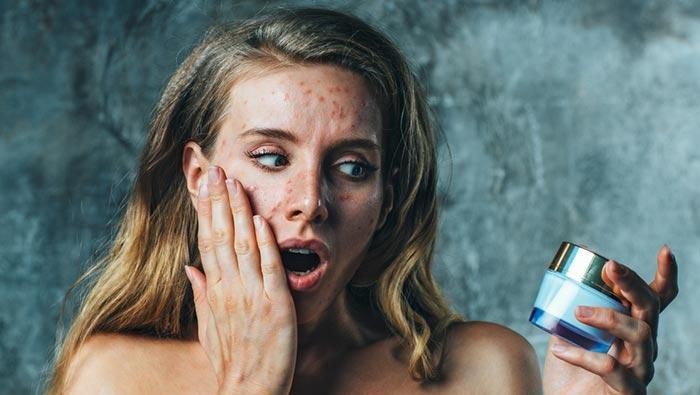 Mengalami Tanda-tanda Ini? Waspada, Mungkin Kamu Alergi Produk Kecantikan!