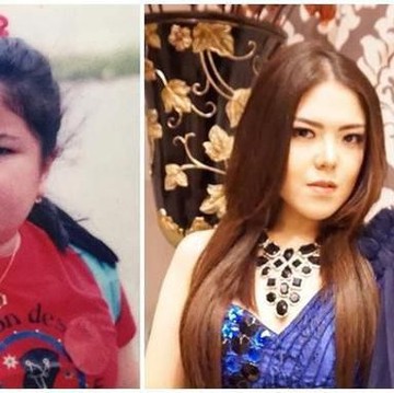 img-title Dari Tina Toon Sampai Aurel, Deretan Artis Ini Sempat Diisukan Melakukan Operasi Plastik