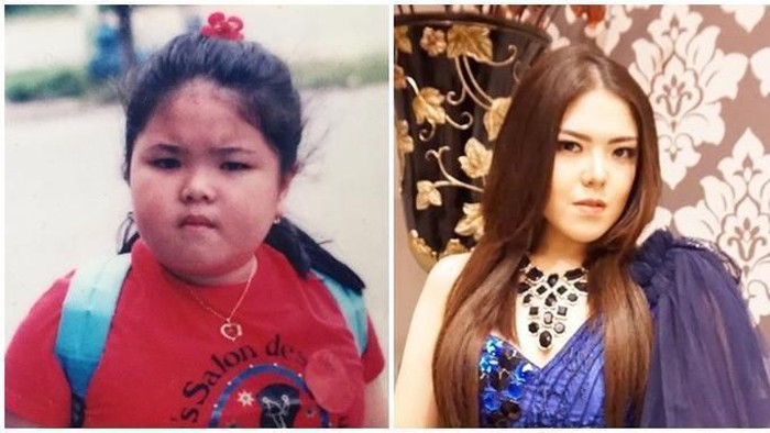 Dari Tina Toon Sampai Aurel, Deretan Artis Ini Sempat Diisukan Melakukan Operasi Plastik