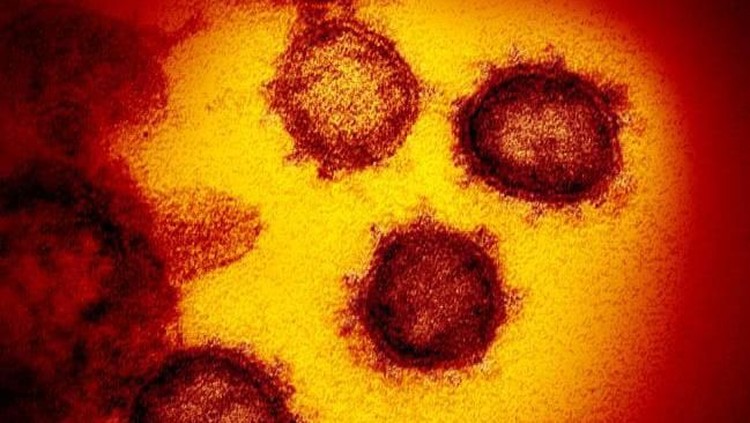 virus corona COVID-19 menginvasi sel-sel tubuh pasien