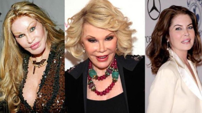 Bukannya Cantik, Artis Ini Justru Punya Wajah Aneh Setelah Oplas