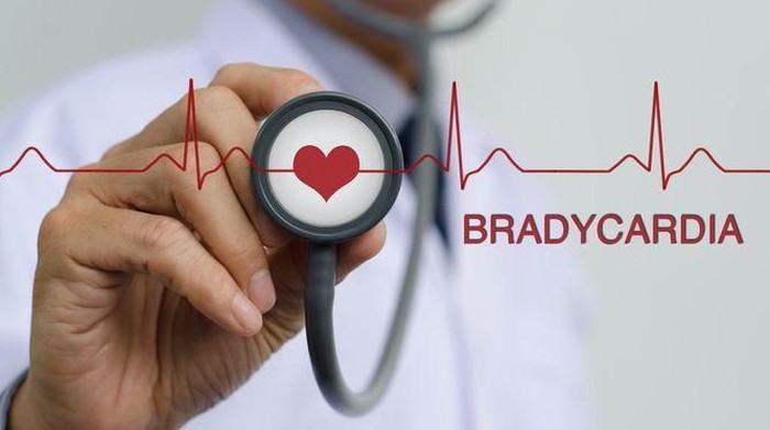 Penyebab Bradikardia, Detak Jantung Lemah yang Berbahaya