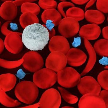 img-title Bukan hanya Anemia, Ini Penyakit Kelainan Darah yang Perlu Kamu Tahu!