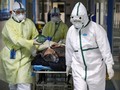 Seorang WN Prancis Meninggal Usai Terinfeksi Virus Corona