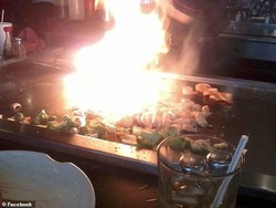 Duh! Wajah Wanita Ini Terbakar Gara-gara Kena Api Teppanyaki