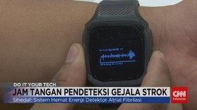 VIDEO: Jam Tangan Pendeteksi Gejala Strok