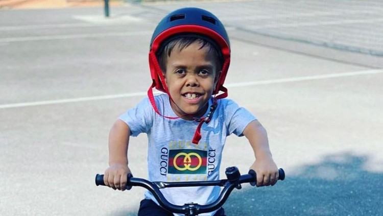 Bocah kerdil Quaden Bayles, yang viral karena di-bully, mendapatkan donasi sekitar Rp5 miliar. Sayangnya, muncul dugaaan Quaden seorang penipu.