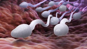 5 Penyebab Sperma Encer: Ejakulasi sampai Celana Ketat
