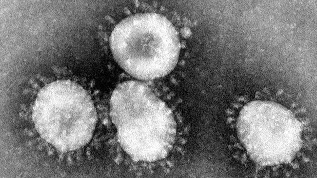 7 Jenis Virus Mematikan Di Dunia