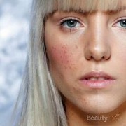 [FORUM] Pernah Breakout Parah Karena Skincare Palsu? Cerita dong