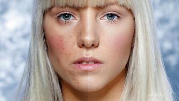 [FORUM] Pernah Breakout Parah Karena Skincare Palsu? Cerita dong