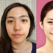 Sebelum Mengalami Operasi Plastik Gagal, Ini Serba-Serbi Sistemnya di Korea yang Wajib Kamu Ketahui