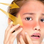 Gak Bikin Kulit Terbakar, Ini Rekomendasi Sunblock yang Bagus