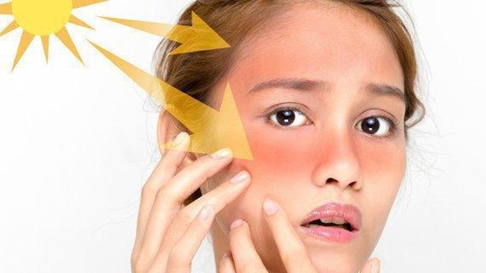 Gak Bikin Kulit Terbakar, Ini Rekomendasi Sunblock yang Bagus Gak Bikin Kulit Terbakar, Ini Rekomendasi Sunblock yang Bagus