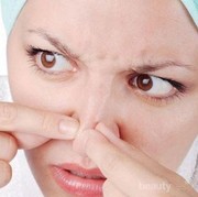 Gak Perlu Repot, Begini Cara Menghilangkan Komedo Permanen Pakai Bahan Alami!