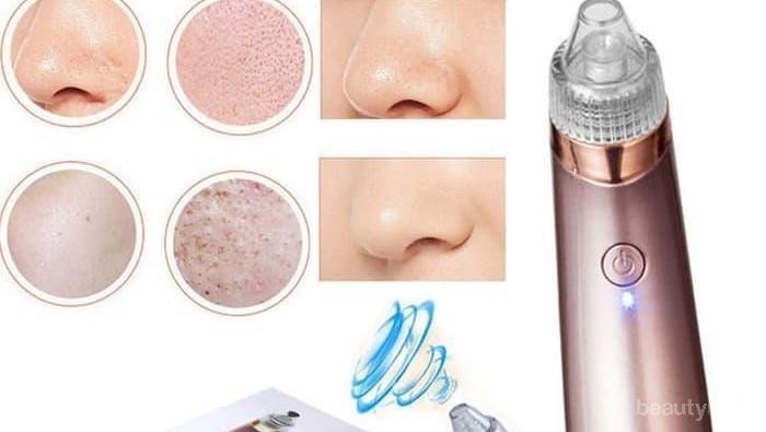 [FORUM] Alat Penyedot Komedo Bikin Pori-pori Makin Besar?