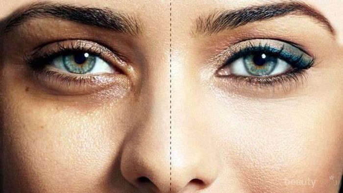 [FORUM] Ladies, aku mau sharing DIY untuk masker kantong mata