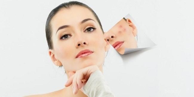 [FORUM] Gimana cara ngatasin jerawat mendem ( jerawat dibawah kulit ) ?