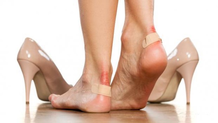 Kaki Sering Lecet Karena Sepatu Flat? Yuk Lakukan 4 Tips Pencegahan Ini, Ladies!