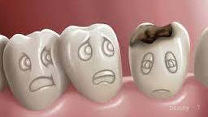 10 Kebiasaan yang Dapat Merusak Gigi