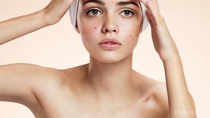 [FORUM] Masih percaya kacang bisa bikin jerawatan ngga?