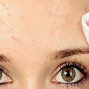 [FORUM] Help! Cara ilangin bruntusan di wajah gimana ya?