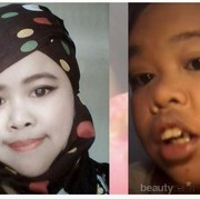[FORUM] Ada yang coba beauty hack pakai balon dengan air ala Rahmawati Kekeyi?