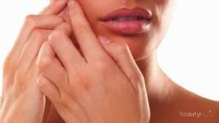 Cara Mudah Mencegah Jerawat