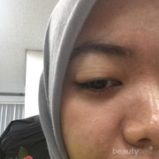 [FORUM] Ternyata bintitan, penyebabnya debu dan mata yang lelah pernah mengalaminya?