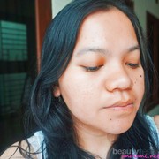 [FORUM] Pernah Coba Vitacid Buat Hilangkan Komedo? Wah, Ampuh Dear!