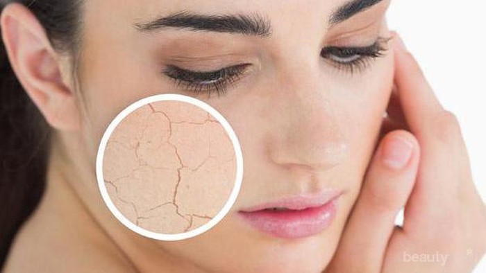 Mengatasi Kulit Wajah yang Kering dan Kusam Dengan Menggunakan Bahan Alami