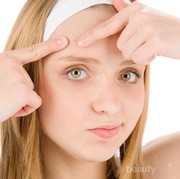 Cara Menghilangkan Jerawat Kecil-kecil di Dahi, Ampuh dan Cepat!