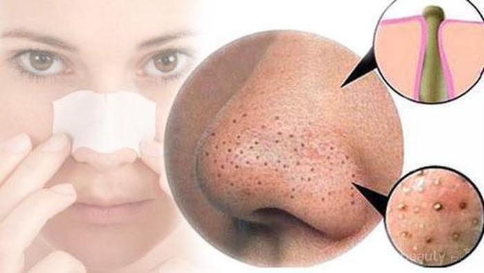 5 Bahan Alami Perkecil Pori Wajah