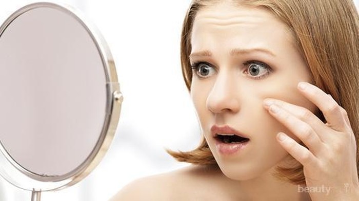 Inilah 4 Masalah Kulit Wajah Karena Kulit Dehidrasi