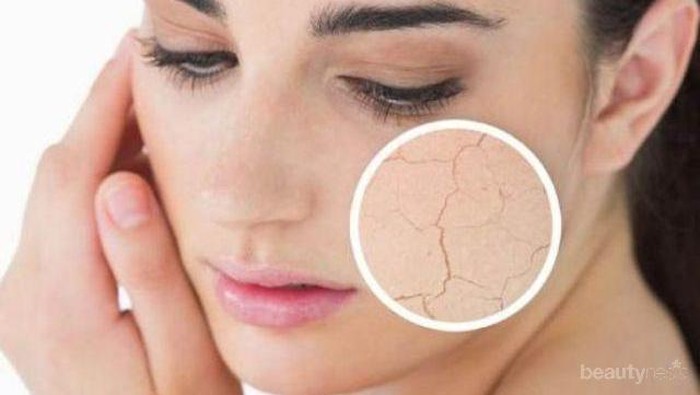 Masker Susu & Madu Ampuh Atasi Kulit Kusam