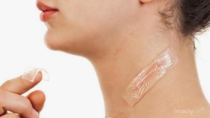 Cara Alami Menghilangkan Bekas Luka