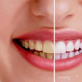 8 Bahan Alami yang Bermanfaat untuk Memutihkan Gigi
