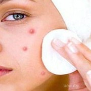Menutupi Noda Jerawat dengan Makeup