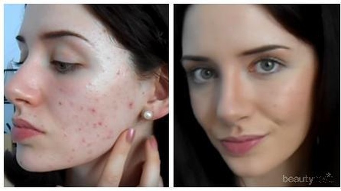 Makeup untuk Tutupi Masalah Jerawat
