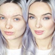 5 Langkah Tepat Aplikasikan Makeup untuk Wajah Berjerawat