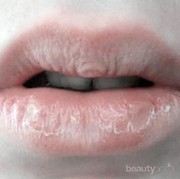 Lakukan 4 Hal Ini untuk Merawat Bibir Saat Puasa