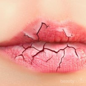 3 Lip Balm Atasi Bibir Kering Dengan Harga Terjangkau