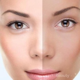 Yuk, Kontrol Melanin untuk Cerahkan Warna Kulit