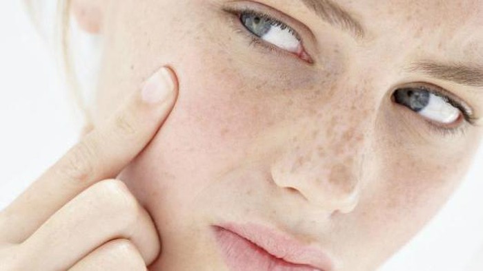 Kenali 5 Tanda Bahwa Produk Kecantikan yang Kamu Pakai Tidak Cocok