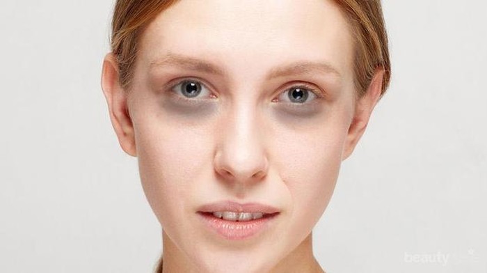 Ini Dia Mata Panda Tanda Penyakit yang Harus Diwaspadai!