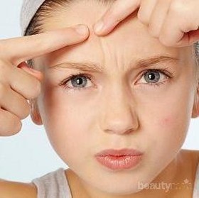 Atasi Masalah Jerawat di Rumah Dengan Cara Ini