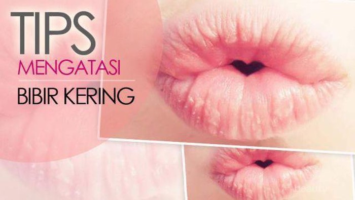 3 Terapi Atasi Bibir Kering Saat Puasa