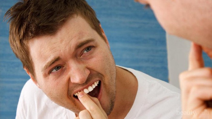 Hindari Makanan Ini untuk Gigi Sehat